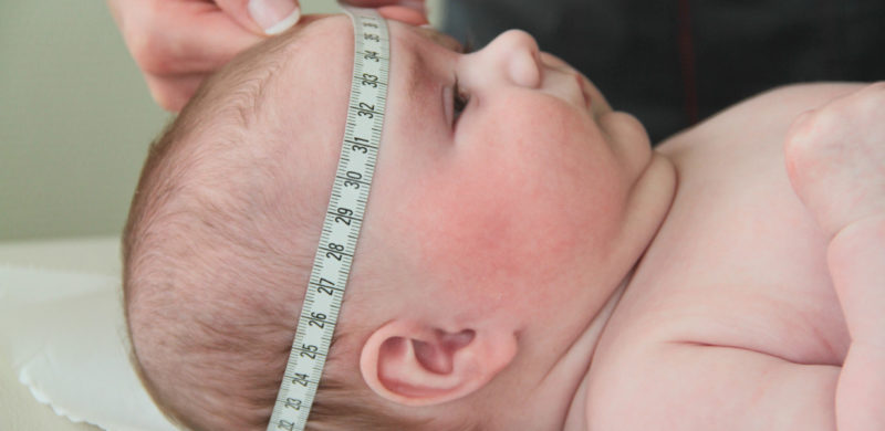 Le nouveau-né de faible poids de naissance : prise en charge des 3  premières années