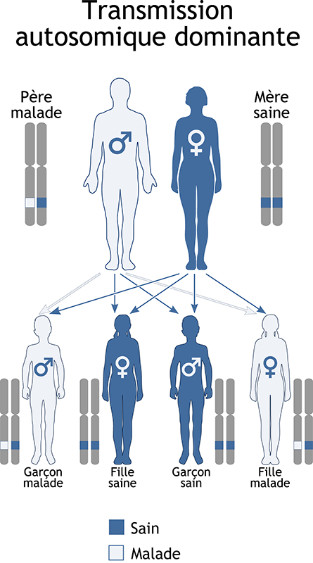 Schéma transmission autosomique dominante